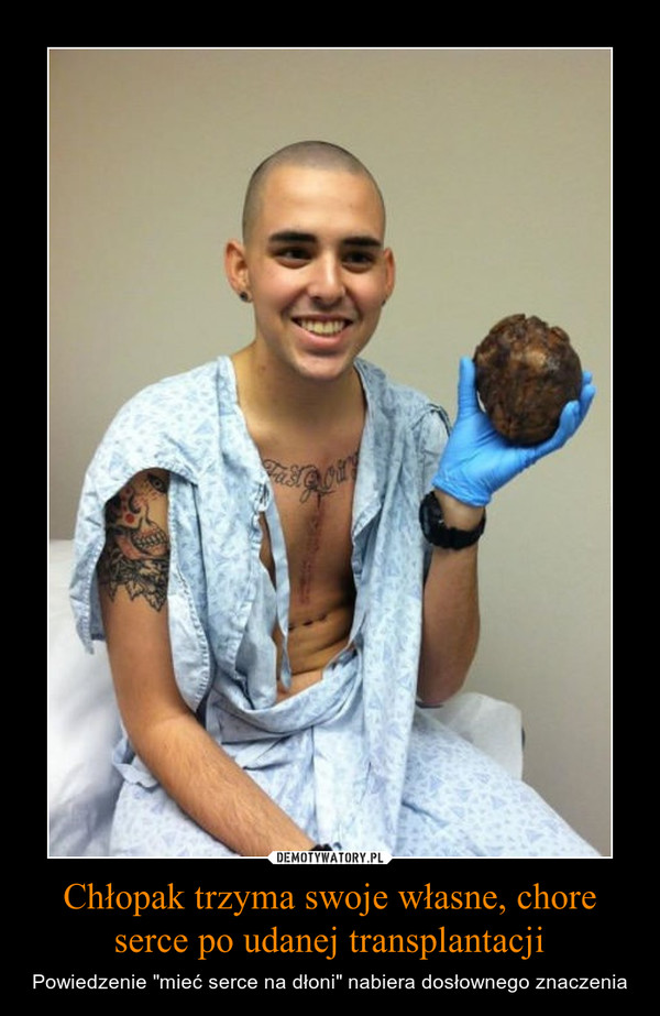 Chłopak trzyma swoje własne, chore serce po udanej transplantacji – Powiedzenie "mieć serce na dłoni" nabiera dosłownego znaczenia 