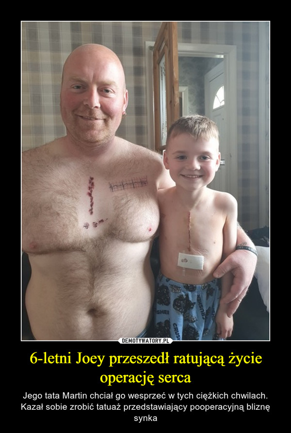 6-letni Joey przeszedł ratującą życie operację serca – Jego tata Martin chciał go wesprzeć w tych ciężkich chwilach. Kazał sobie zrobić tatuaż przedstawiający pooperacyjną bliznę synka 