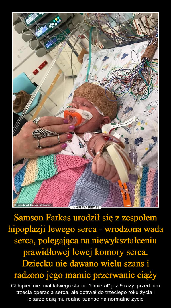 Samson Farkas urodził się z zespołem hipoplazji lewego serca - wrodzona wada serca, polegająca na niewykształceniu prawidłowej lewej komory serca. Dziecku nie dawano wielu szans i radzono jego mamie przerwanie ciąży