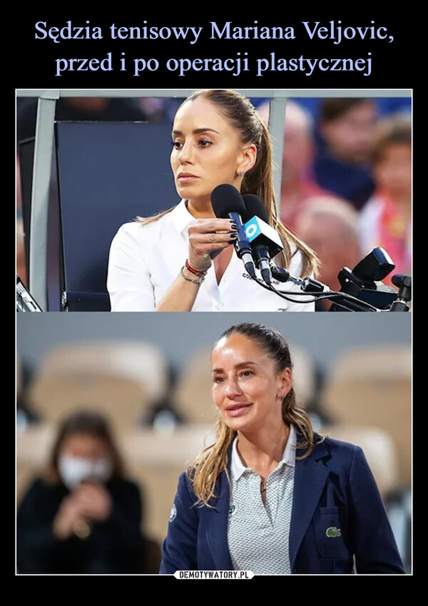Sędzia tenisowy Mariana Veljovic, przed i po operacji plastycznej